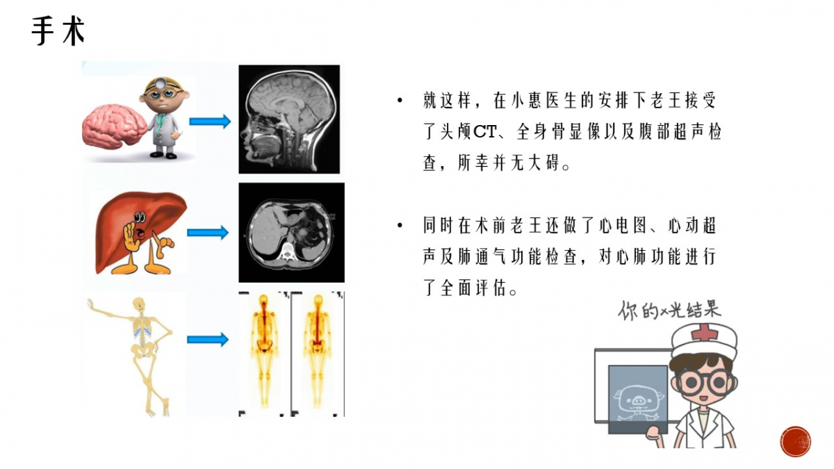 image-20220817174542-47